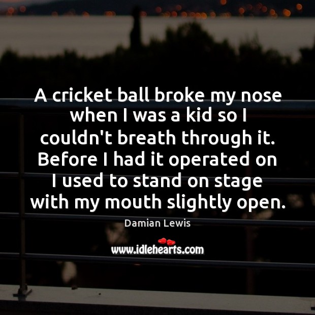 A cricket ball broke my nose when I was a kid so Image
