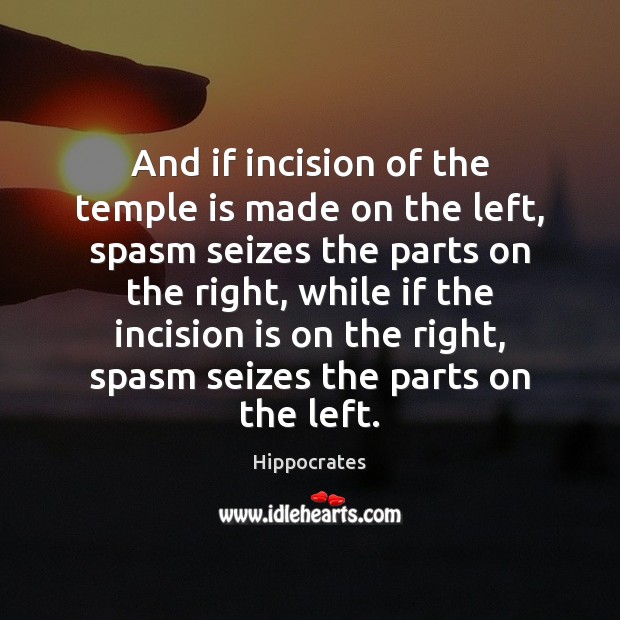And if incision of the temple is made on the left, spasm Hippocrates Picture Quote