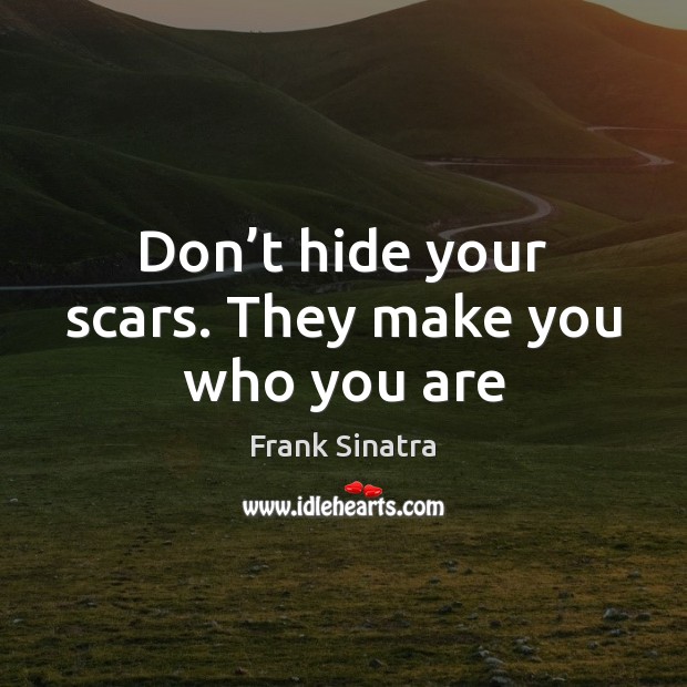 Don’t hide your scars. They make you who you are Frank Sinatra Picture Quote