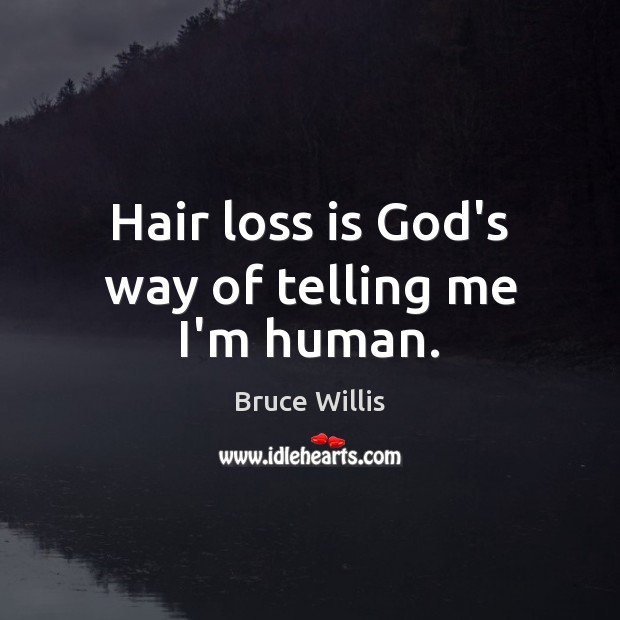 Hair loss is God’s way of telling me I’m human. Image