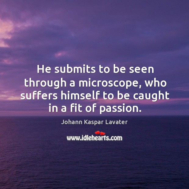 He submits to be seen through a microscope, who suffers himself to be caught in a fit of passion. Passion Quotes Image