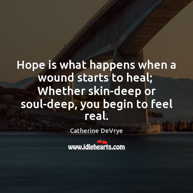 Hope is what happens when a wound starts to heal;  Whether skin-deep Hope Quotes Image
