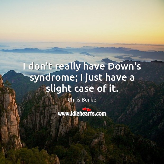 I don’t really have Down’s syndrome; I just have a slight case of it. Image