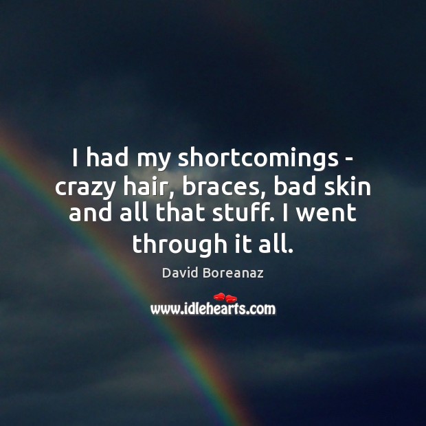 I had my shortcomings – crazy hair, braces, bad skin and all David Boreanaz Picture Quote