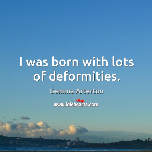 I was born with lots of deformities. Image