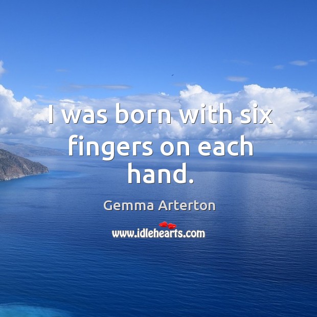 I was born with six fingers on each hand. Image