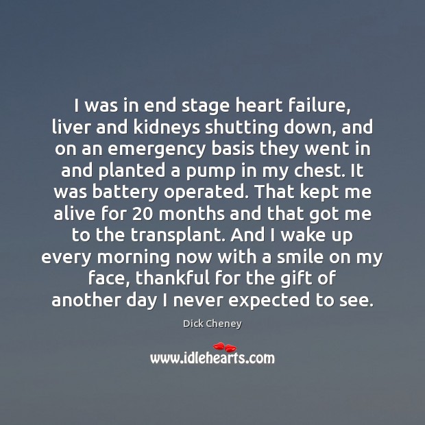 I was in end stage heart failure, liver and kidneys shutting down, Image