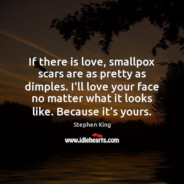 If there is love, smallpox scars are as pretty as dimples. I’ll Image