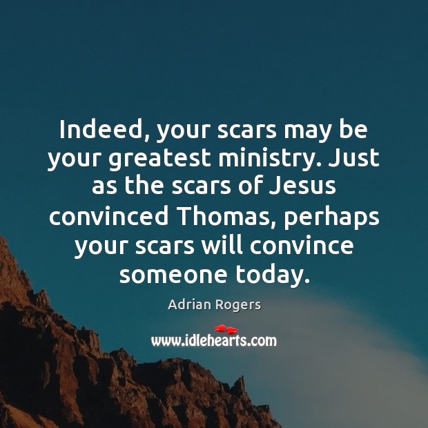 Indeed, your scars may be your greatest ministry. Just as the scars Adrian Rogers Picture Quote