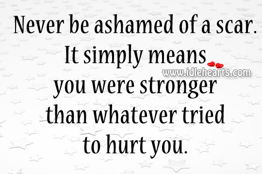 Never be ashamed of a scar. Image