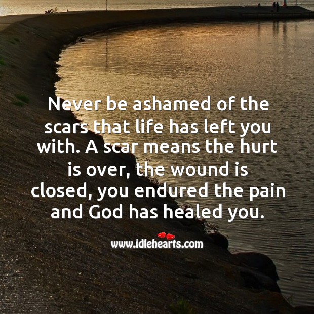 Never be ashamed of the scars that life has left you with. Image