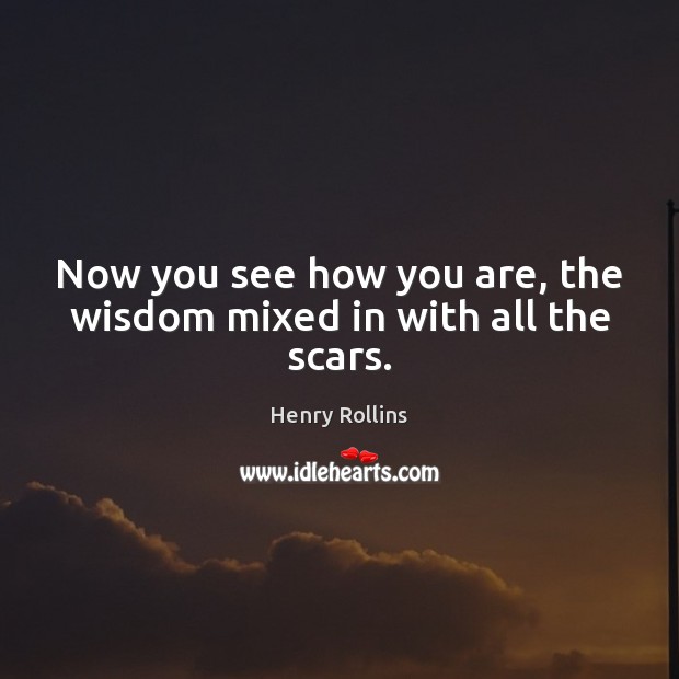 Now you see how you are, the wisdom mixed in with all the scars. Henry Rollins Picture Quote