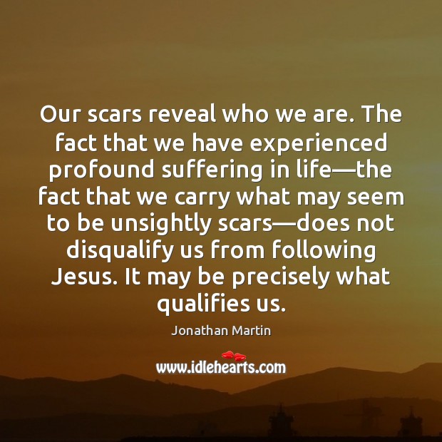 Our scars reveal who we are. The fact that we have experienced Image