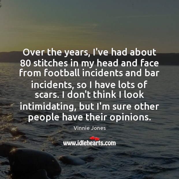 Over the years, I’ve had about 80 stitches in my head and face Image
