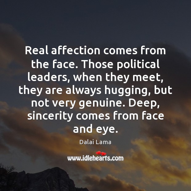Real affection comes from the face. Those political leaders, when they meet, Image