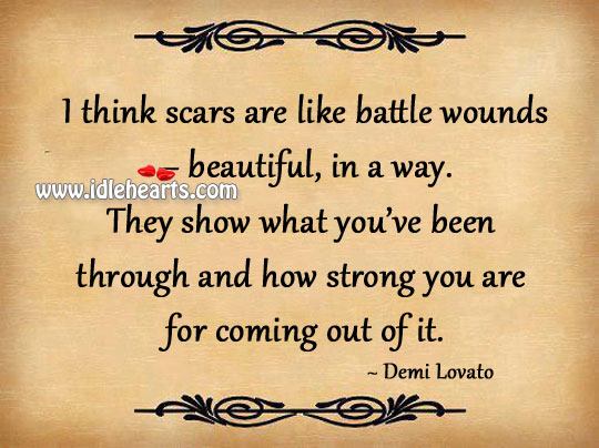 Scars are like battle wounds Demi Lovato Picture Quote