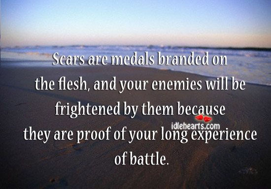 Scars are proof of your long experience of battle. Image
