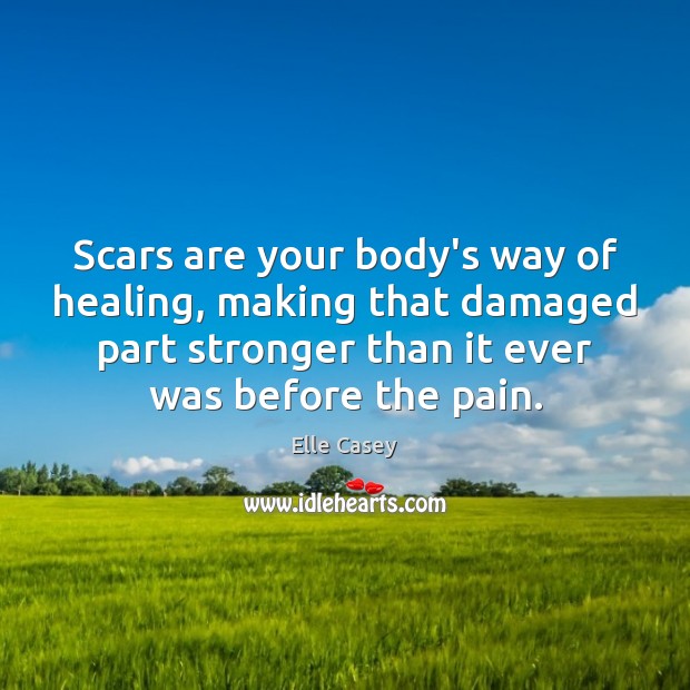 Scars are your body’s way of healing, making that damaged part stronger Image