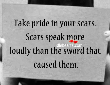 Take pride in your scars. Image