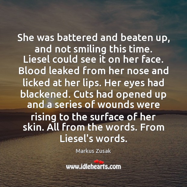 She was battered and beaten up, and not smiling this time. Liesel Image