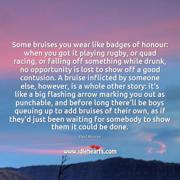 Some bruises you wear like badges of honour: when you got it Image