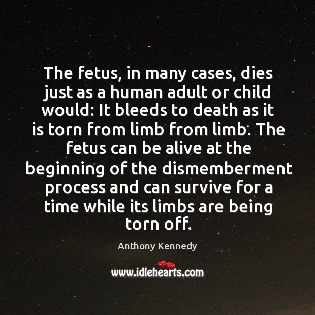 The fetus, in many cases, dies just as a human adult or Anthony Kennedy Picture Quote