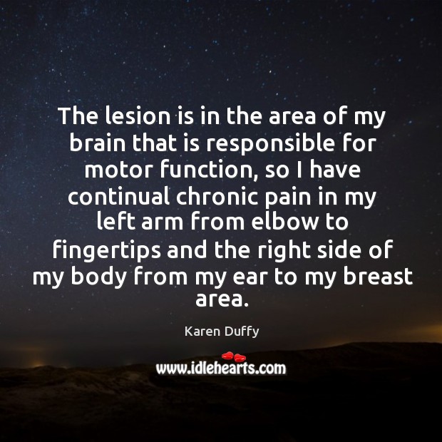 The lesion is in the area of my brain that is responsible for motor function Karen Duffy Picture Quote