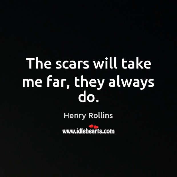 The scars will take me far, they always do. Image