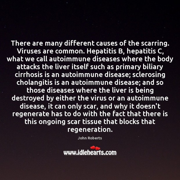 There are many different causes of the scarring. Viruses are common. Hepatitis John Roberts Picture Quote