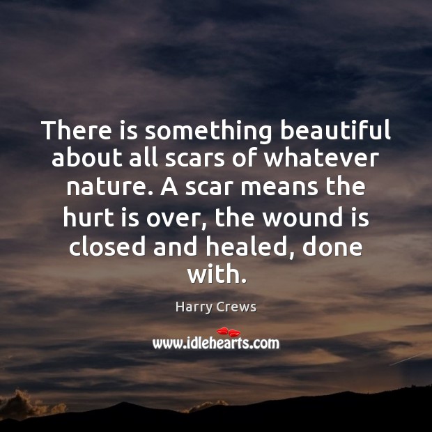 There is something beautiful about all scars of whatever nature. A scar Hurt Quotes Image
