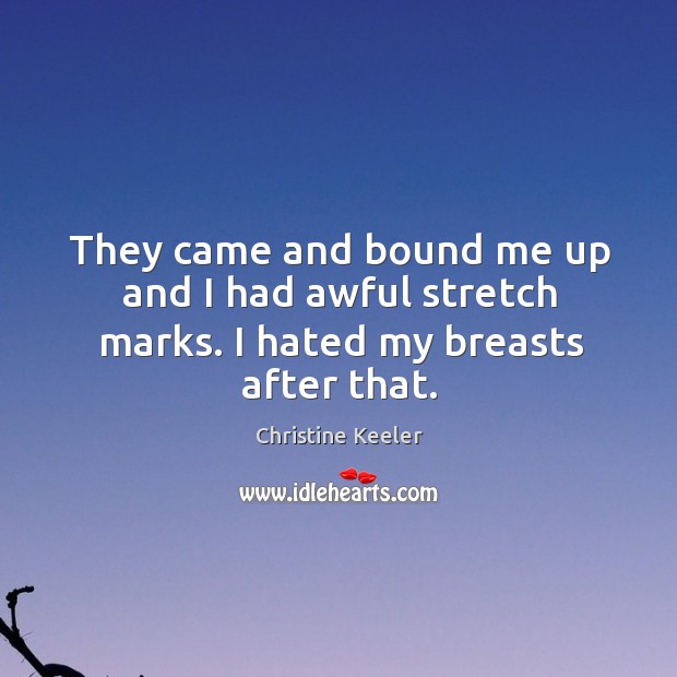 They came and bound me up and I had awful stretch marks. I hated my breasts after that. Christine Keeler Picture Quote