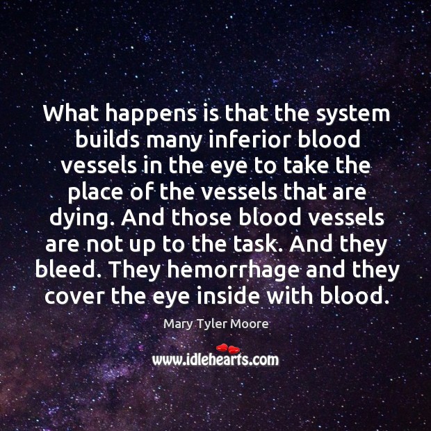 They hemorrhage and they cover the eye inside with blood. Mary Tyler Moore Picture Quote