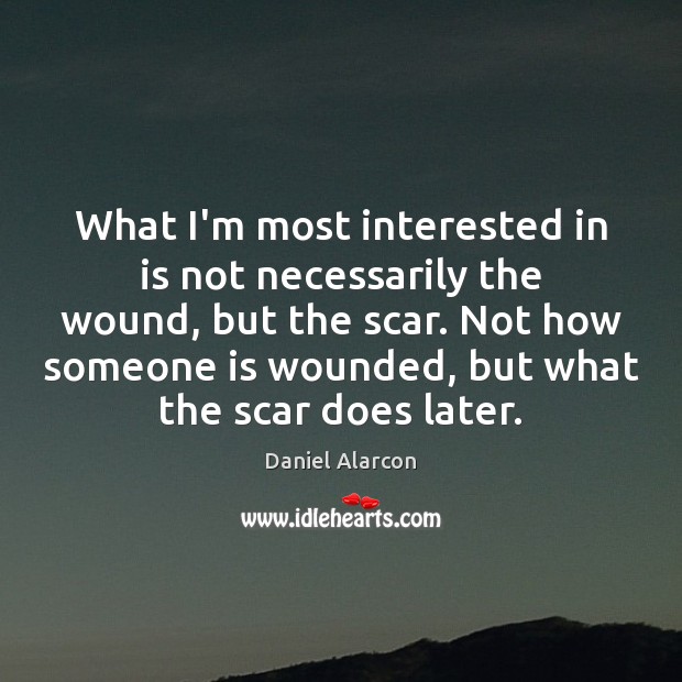 What I’m most interested in is not necessarily the wound, but the Daniel Alarcon Picture Quote