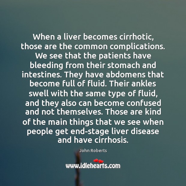 When a liver becomes cirrhotic, those are the common complications. We see John Roberts Picture Quote