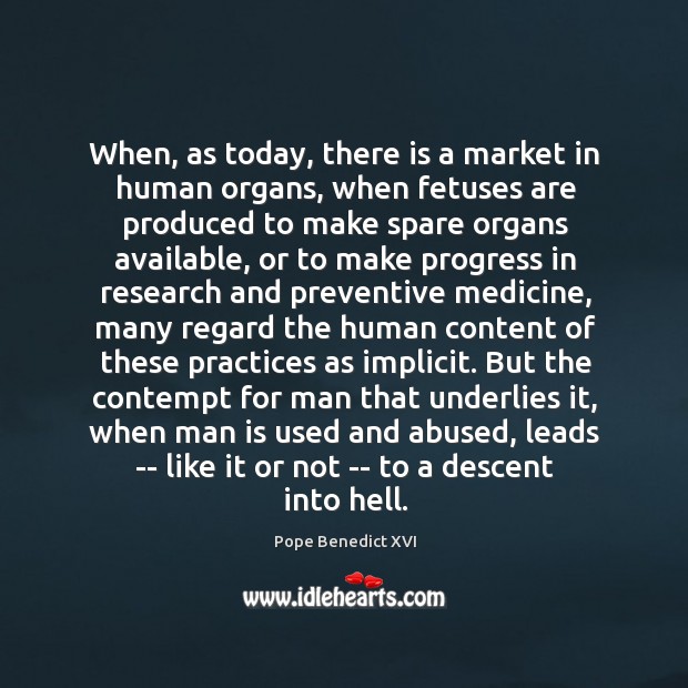 When, as today, there is a market in human organs, when fetuses Image