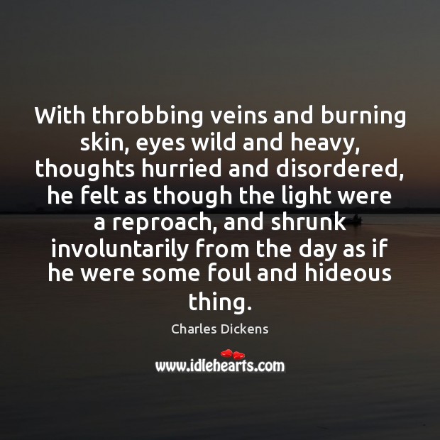 With throbbing veins and burning skin, eyes wild and heavy, thoughts hurried Charles Dickens Picture Quote
