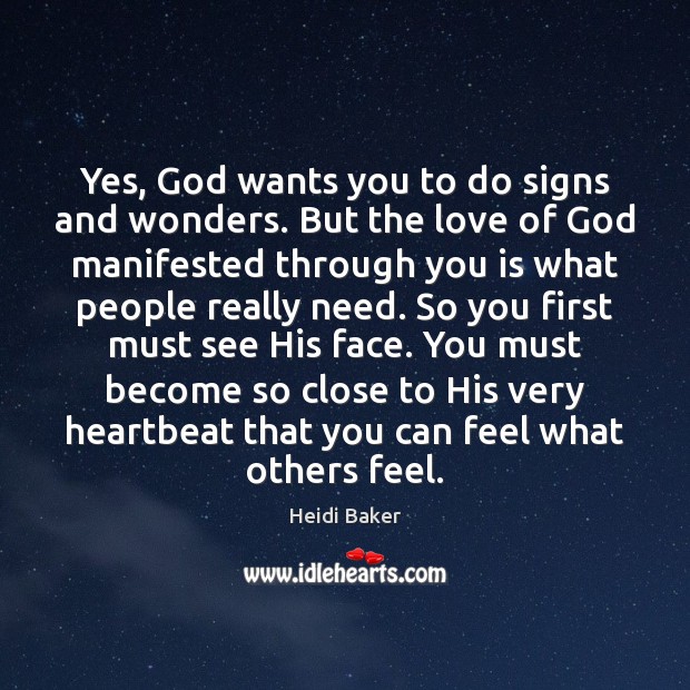 Yes, God wants you to do signs and wonders. But the love Image