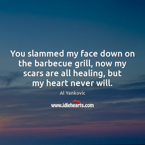 You slammed my face down on the barbecue grill, now my scars Al Yankovic Picture Quote