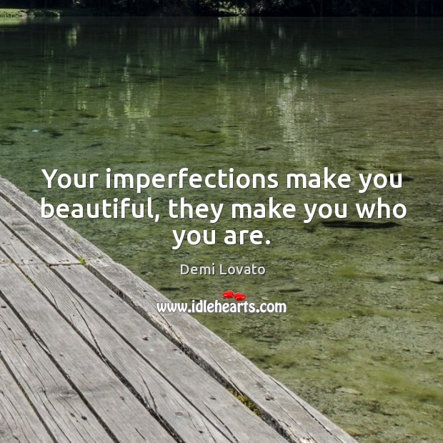 Your imperfections make you beautiful, they make you who you are. Image